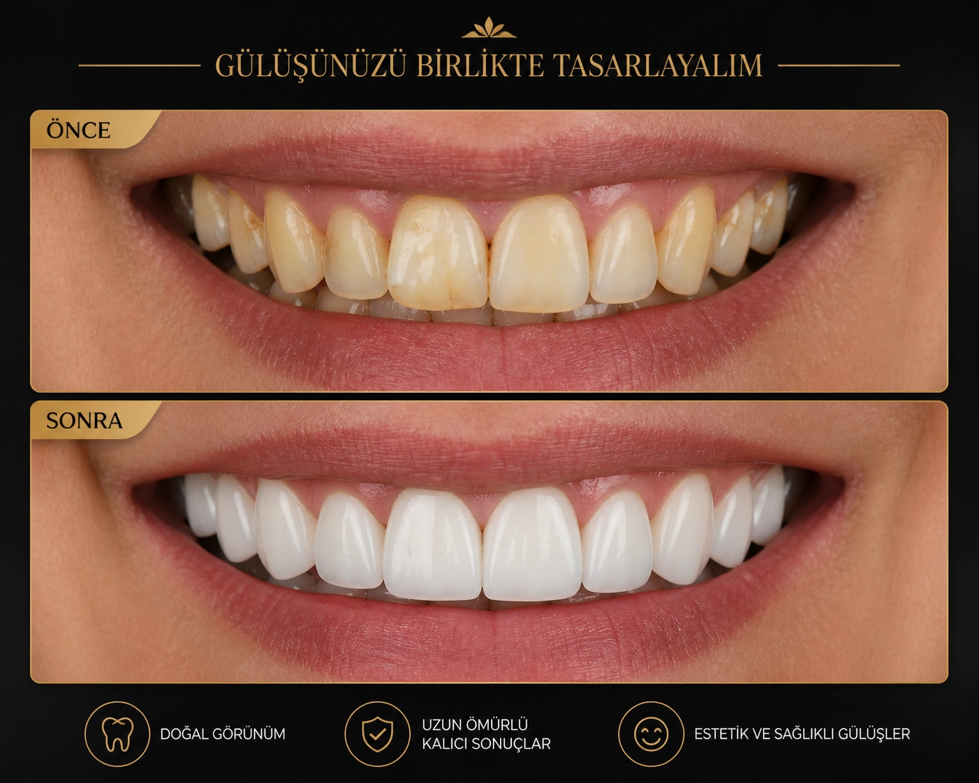 Hastalarımızın Gülüş Yolculuğu